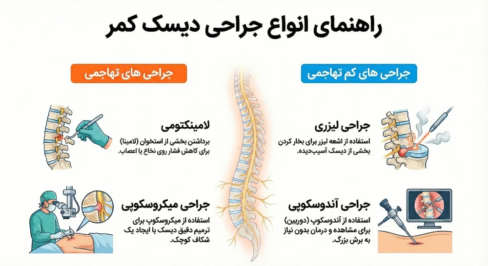 انواع مختلف جراحی دیسک کمر