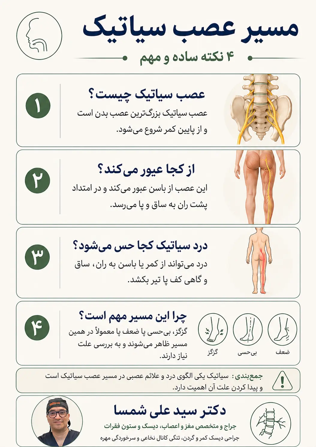 مسیر عصب سیاتیک