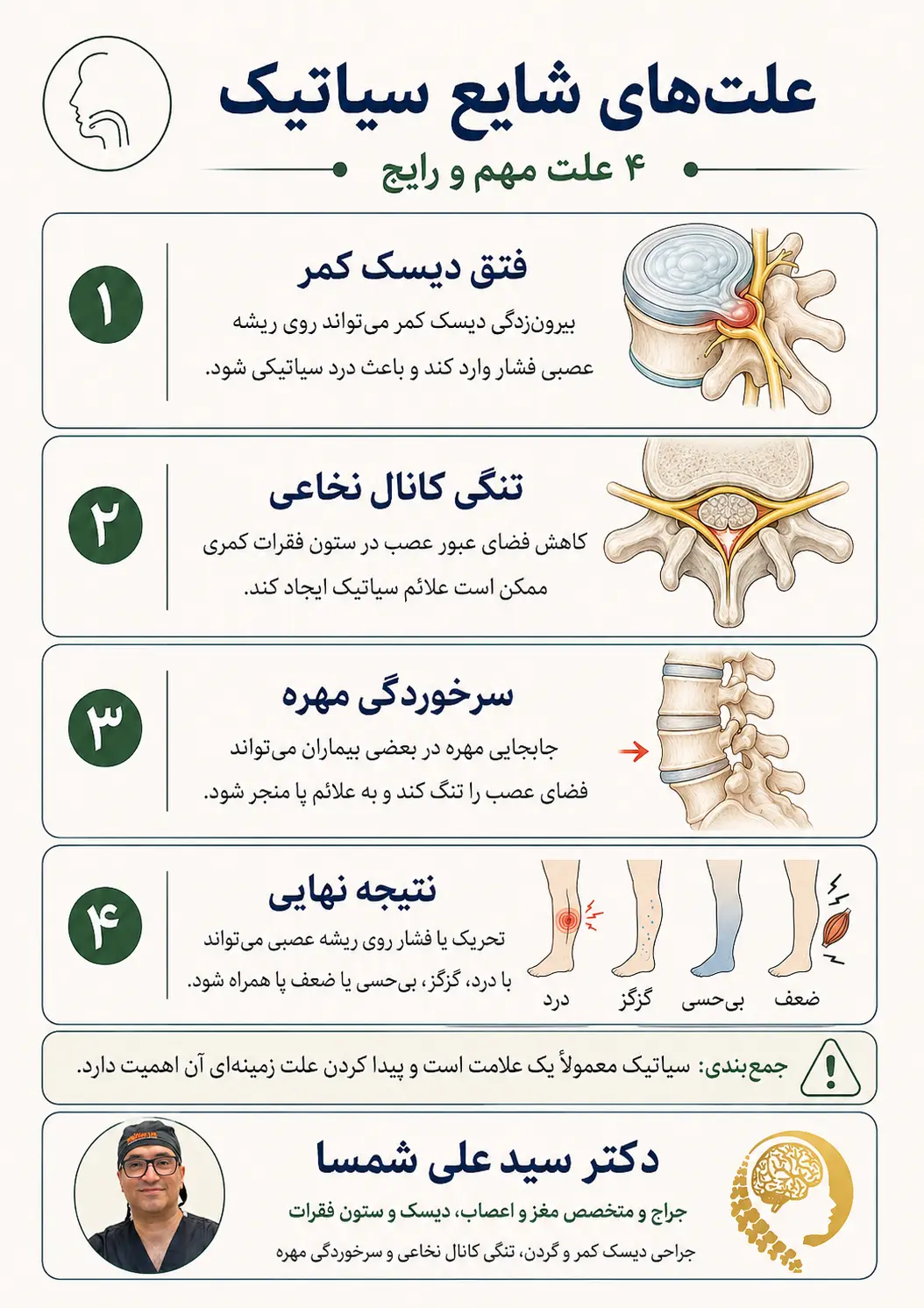 علت های سیاتیک