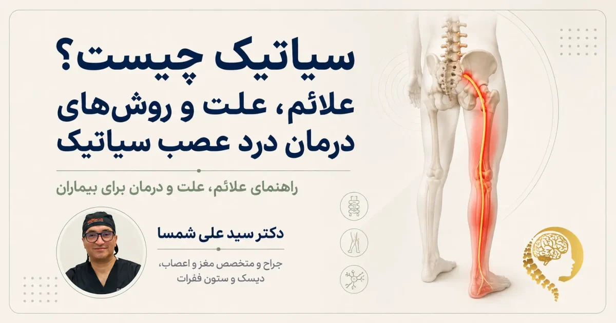 سیاتیک و مسیر درد عصب سیاتیک از کمر تا پا
