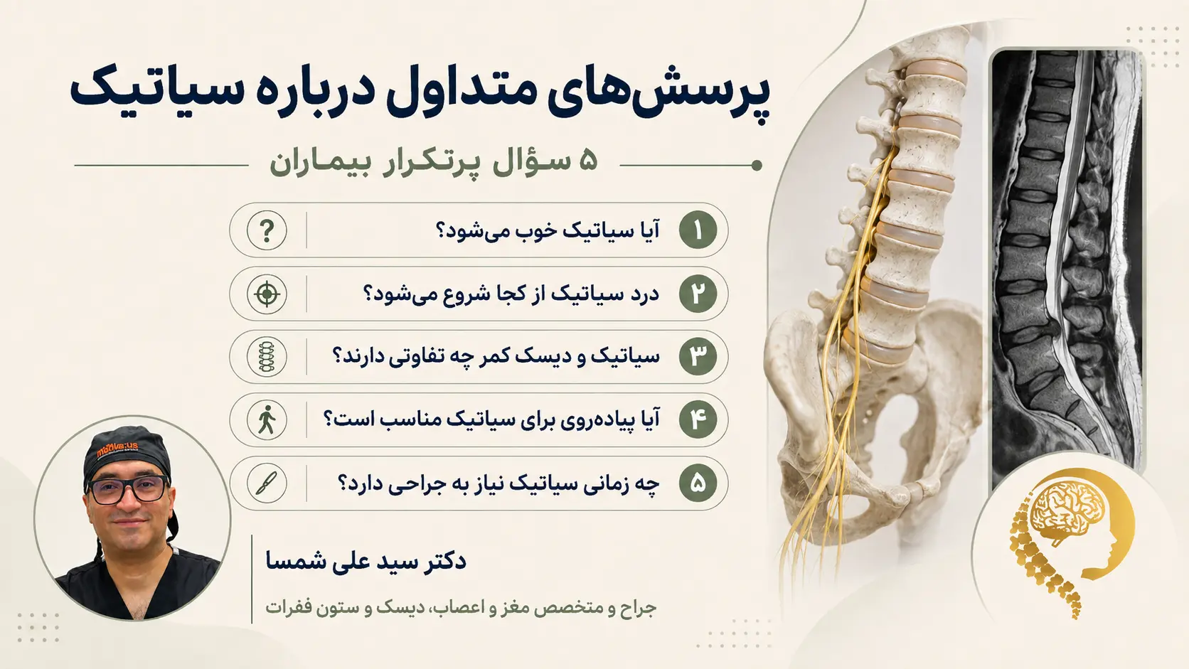 سوالات متداول سیاتیک