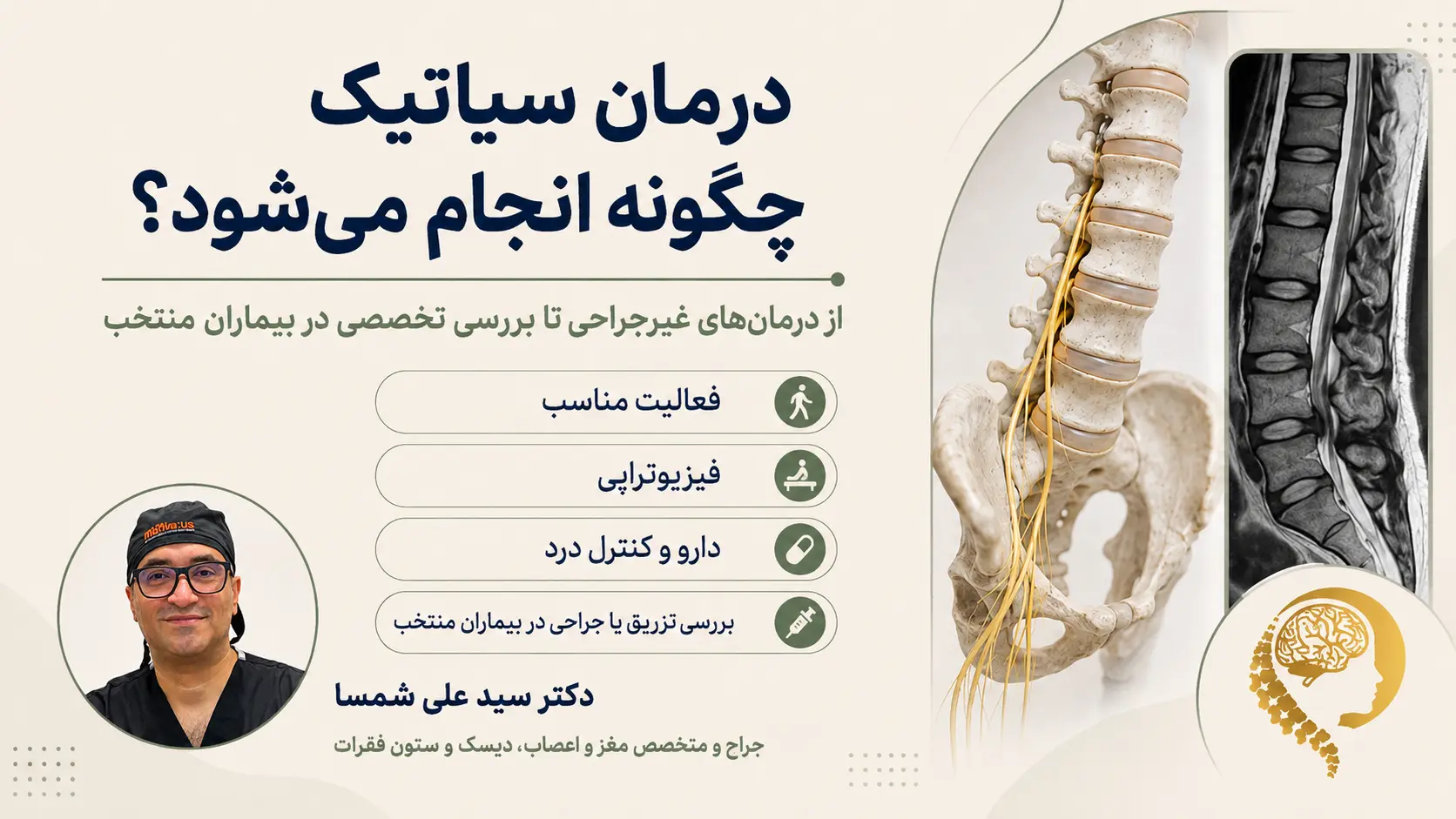 درمان سیاتیک